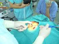 Lokal Anestezi Nedir? ve Nasıl Yapılır 